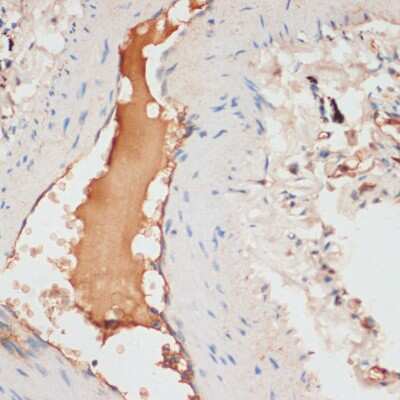 Immunohistochemistry-Paraffin: Apolipoprotein C1 Antibody [NBP2-91001] - Immunohistochemistry of paraffin-embedded human lung using Apolipoprotein C1 antibody (NBP2-91001) at dilution of 1:100 (40x lens). Perform microwave antigen retrieval with 10 mM PBS buffer pH 7.2 before commencing with IHC staining protocol.